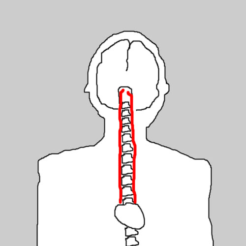 Vertebral arteries